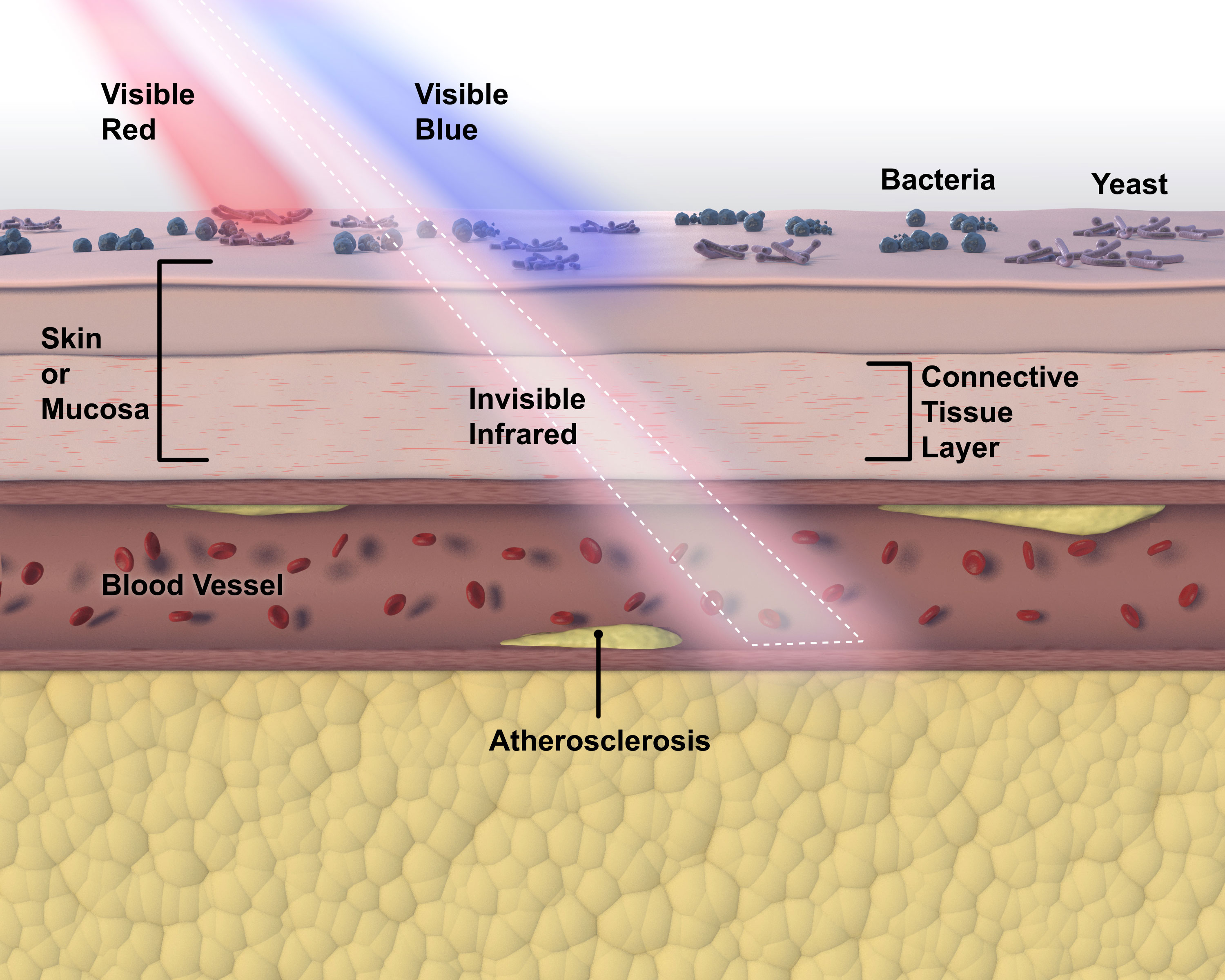PulseWave™ (Image 1)