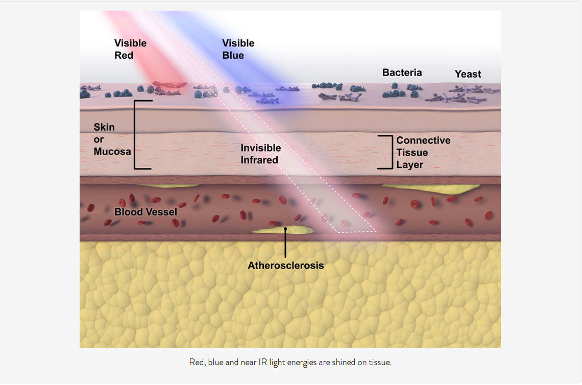 PulseWave™ (Image 1 with text)