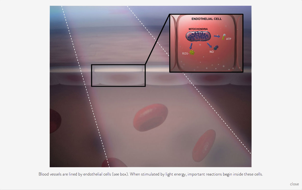 PulseWave™ Microscopic (Image 3 with text)